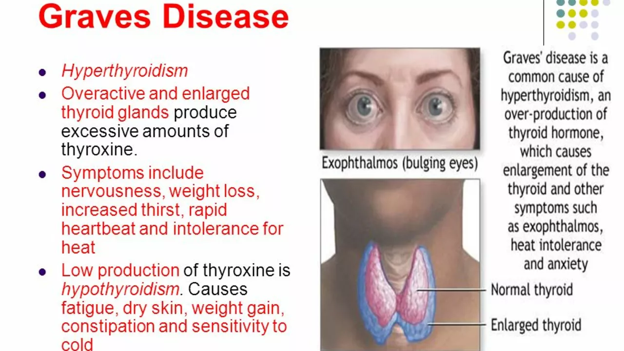 Hyperthyroidism in Men: Symptoms, Diagnosis, and Treatment