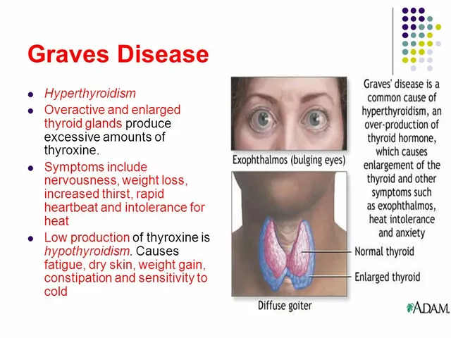 Navigating Relationships with Graves' Disease: Tips and Advice